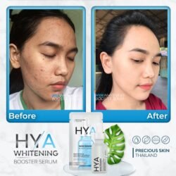 63de9ca4192e062ab43388ff6878e3fe.jpg Precious Skin Thailand HYA Whitening Serum hwbs