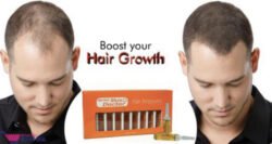55d9097ea084b5bc9a2bb43aad4fff56.jpg 10 Pcs (1 Full Box) Herbal SKIN DOCTOR HAIR GROWTH AMPOULES for Hair Treatment with Anti-Hair Fall. Formulated In FRANCE 10ML Hshg