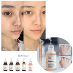 The ORDINARY Lactic Acid 10% + HA 2% Superficial Peeling Formulation 30ml