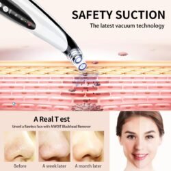 Led Display Blackhead Remover Mrbd Rechargeable 6 Head  Machine Multifunctional Pore Vacuum –  Electric Acne Tool, Suction Power with Led Display