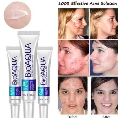 e060173840c51d886f3ff6f5fbc84185.jpg Natural Ingredient BIOAQUA PURE SKIN Anti Acne Scar Mark Remove Oil Control Shrink Pores Remove Pimples Blackhead Anti-Wrinkle Treatment Removal CREAM Spots Scar Blemish Marks fcca