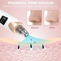 Led Display Blackhead Remover Mrbd Rechargeable 6 Head  Machine Multifunctional Pore Vacuum –  Electric Acne Tool, Suction Power with Led Display
