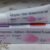 f207398d3696937ea769f5867298f6c8.jpg Rx SKINLITE (SKIN LITE ) Hydroquinone + Tretinoin + Mometasone Furoate CREAM 25g (slht)
